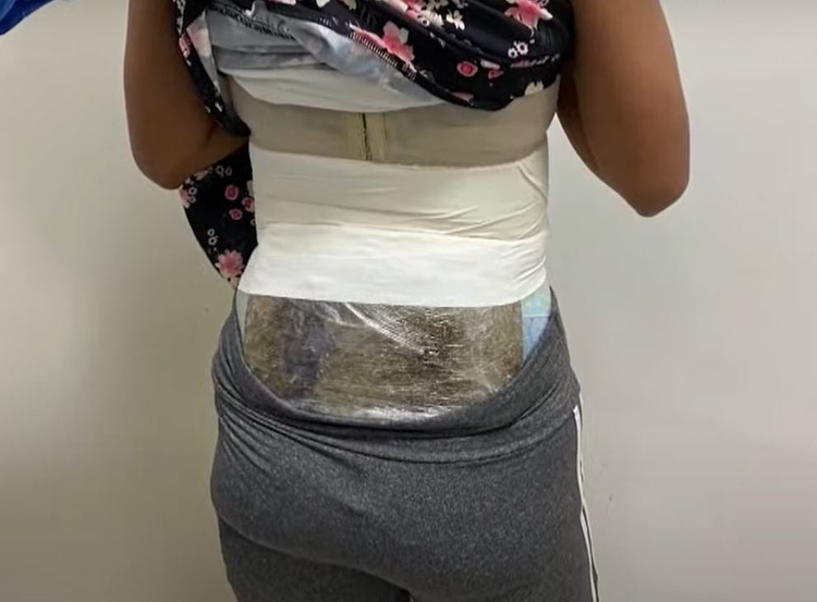 Com drogas coladas ao corpo, mulher é presa por tentativa de tráfico